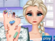 Play Elsa Foot Doctor