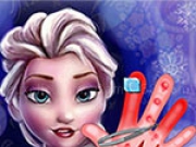 Jugar a Elsa Hand Surgery