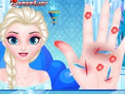 Play Doctor Frozen Elsa Hand