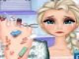 Play Elsa foot doctor