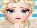 Play Squeeze elsa pimples