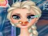 Play Elsa nose doctor