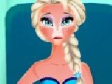 Play Elsa sunburn