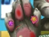 Play Talking tom hand doctor