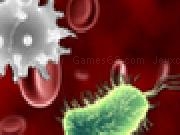 Play Pneumonoultramicroscopicsilicovolcanoconiosis