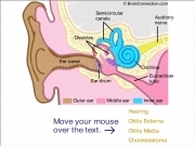 Play Auditory pathology