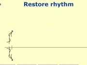 Play Restore rhythm