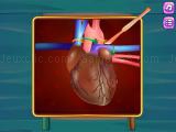 Play Heart transplant surgery